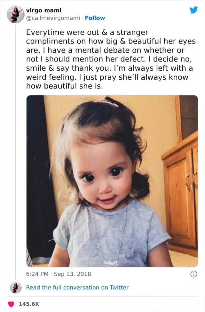 Axenfeld-Rieger Syndrome